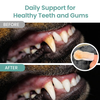 Clean Teeth Finger Wipes